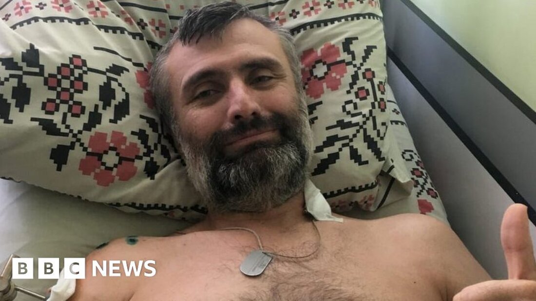 Artjom ist der einzige ukrainische Soldat, dessen Verletzungen in einem schottischen Krankenhaus behandelt werden. Der 41-jährige Vater von fünf Kindern hatte nie damit gerechnet, Soldat zu werden. Vor der russischen Invasion vor einem Jahr war er Berufsmusiker, spielte in einer erfolgreichen Band und studierte klassischen Gesang am staatlichen Konservatorium. Als der Krieg begann, flohen seine Frau und vier seiner Kinder aus Kiew und kamen im Rahmen des Programms Homes for Ukraine nach Schottland. Artem und sein ältester Sohn beschlossen zu bleiben und zu kämpfen. Er sagt: „Es war sehr hart. Ich bin ein Familienmensch, ich liebe meine Frau und meine …