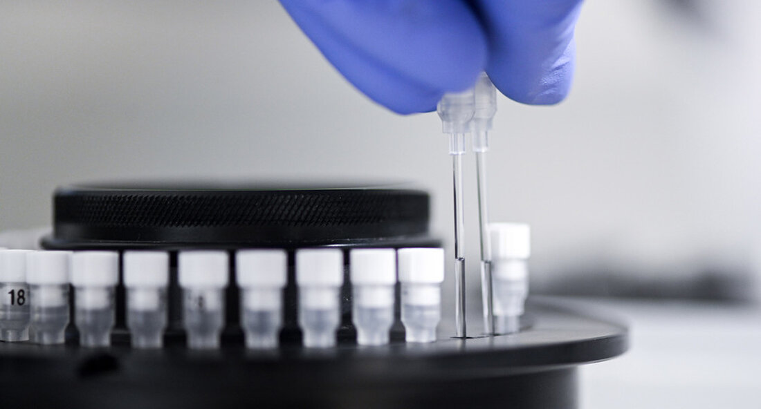 Innovative Testverfahren können einen entscheidenden Beitrag zur Eindämmung der Koronapandemie leisten. Die Entwicklung eines PCR-basierten Corona-Schnelltests, der vom Wirtschaftsministerium mit sechs Millionen Euro finanziert wird, ist nun in Rekordzeit abgeschlossen. Das mobile Testgerät liefert Testergebnisse nach ca. 40 Minuten zum Zeitpunkt der Probenahme und beschleunigt die Erkennung infizierter Personen erheblich. Seit April dieses Jahres hat das Wirtschaftsministerium die Entwicklung eines PCR-basierten Corona-Schnelltests des Freiburger Medizintechnik-Start-ups Spindiag GmbH und des Hahn Schickard Institut für Mikroanalysesysteme finanziert mit sechs millionen euro in freiburg. Wirtschaftsminister ist zusammen mit Dr. Daniel Mark (Leiter des Unternehmens Spindiag), Prof. Roland Zengerle (Direktor des Hahn-Schickard-Instituts Freiburg) und …