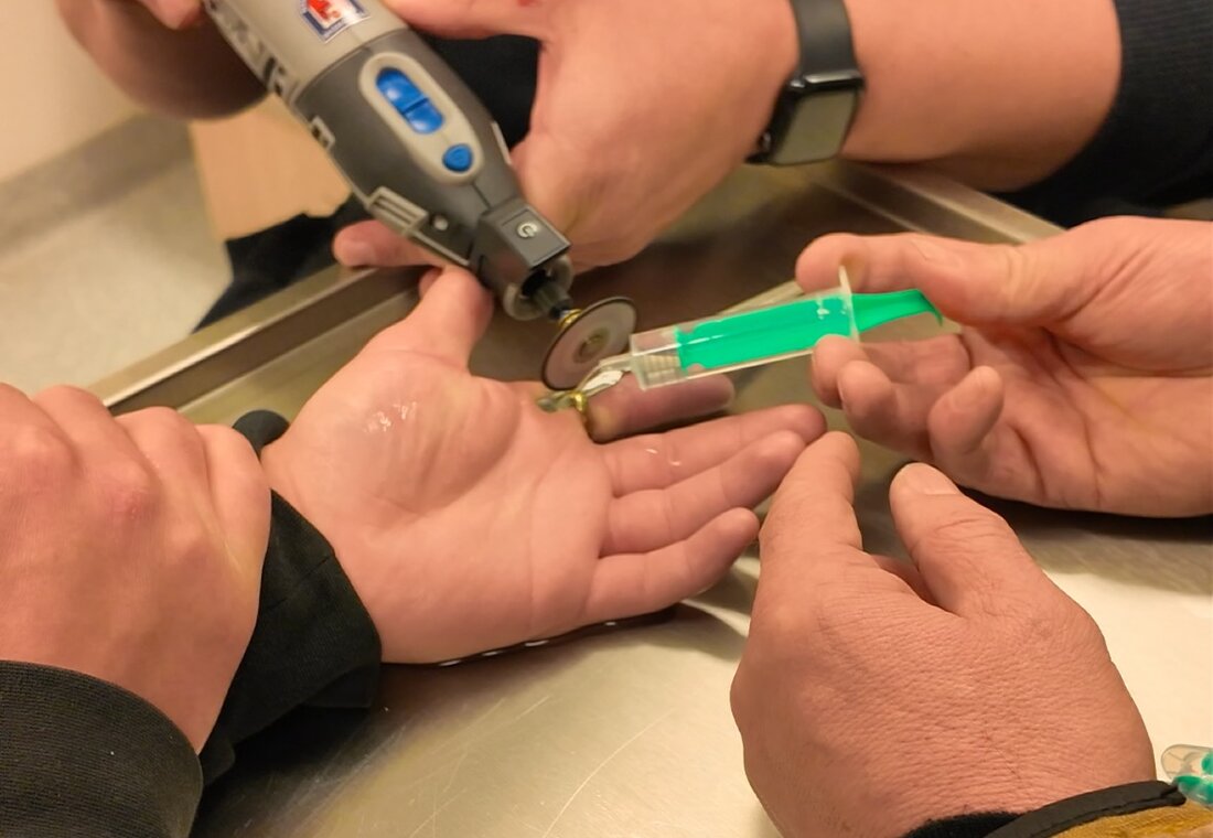 Feuerwehr Wildeshausen hilft in Notaufnahme: Ring entfernt, der Finger des Patienten aufgrund von Schwellung blutstaut.