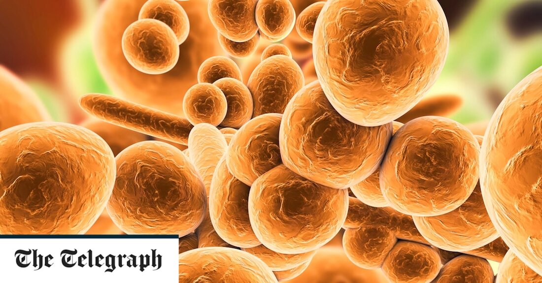 Laut Gesundheitsbehörden wurde im US-Bundesstaat Mississippi erstmals ein arzneimittelresistenter „Super“-Pilz entdeckt. Sieben Patienten wurden behandelt Candida Auris (C. auris) ab Montag, laut Beamten des University of Mississippi Medical Center (UMMC). Die US Centers for Disease Control and Prevention warnen, dass C. auris „ein neu auftretender Pilz ist, der eine ernsthafte globale Gesundheitsbedrohung darstellt“. Die Infektion, die hoch ansteckend und gegen mehrere Antimykotika resistent ist, kann bei Menschen, die bereits wegen mehrerer schwerer oder chronischer Erkrankungen behandelt werden, schwere Erkrankungen verursachen. „Dies ist das erste Mal, dass wir einen lokal erworbenen Fall in Mississippi hatten“, sagte Dr. Bhagyashri Navalkele, außerordentlicher Professor &hellip;