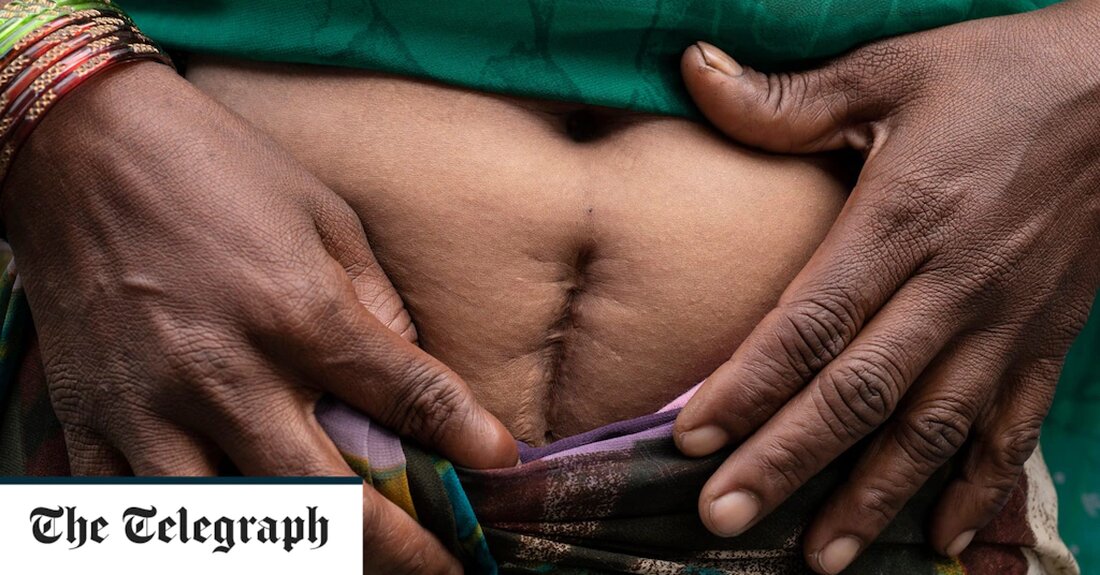 Die chilenische Regierung hat sich öffentlich bei einer HIV-positiven Frau entschuldigt, die vor 20 Jahren von „grausamen“ und „uneinfühlsamen“ Ärzten illegal sterilisiert wurde. In einer wegweisenden Ankündigung am Donnerstag entschuldigte sich der chilenische Staat erstmals für eine nicht autorisierte Operation. Früher war diese Praxis üblich – eine chilenische Studie aus dem Jahr 2004 ergab, dass 50 Prozent der chirurgischen Sterilisationen bei HIV-positiven Frauen ohne Kenntnis des Patienten oder auf Druck von medizinischem Personal durchgeführt wurden. In einem exklusiven Interview erzählte Francisca* dem Telegraph Sie habe „gemischte Gefühle“ über die Entschuldigung, die der Präsident, Gabriel Boric, und die Außenministerin, Antonia Urrejola, &hellip;