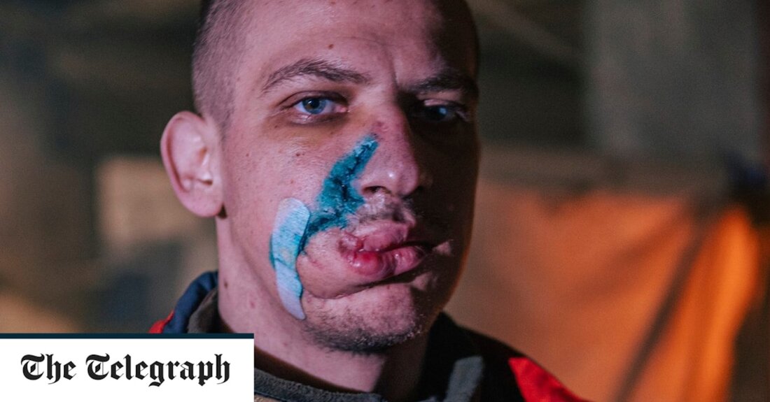 Ukrainekrieg &#8211; Sonderartikel Es ist eine Szenerie, die an die Schrecken des Ersten Weltkriegs erinnert – unrasierte Soldaten in schmutzigen Uniformen, deren Arme und Beine in verbundene Stümpfe enden. Die Bilder stammen jedoch nicht aus den Schützengräben von Ypern oder Flandern, sondern aus der Ukraine ein Jahrhundert später und zeigen verwundete Kämpfer, die im Stahlwerk Azovstal in Mariupol eingeschlossen sind. Die Fotos wurden vom Asowschen Bataillon veröffentlicht, der Einheit, die einen letzten Stand im Werk leistet, um die Notlage ihrer Kämpfer nach 12 Wochen unter Belagerung durch russische Truppen zu zeigen. Kommandeure behaupten, dass angesichts knapper medizinischer Vorräte selbst geringfügige &hellip;