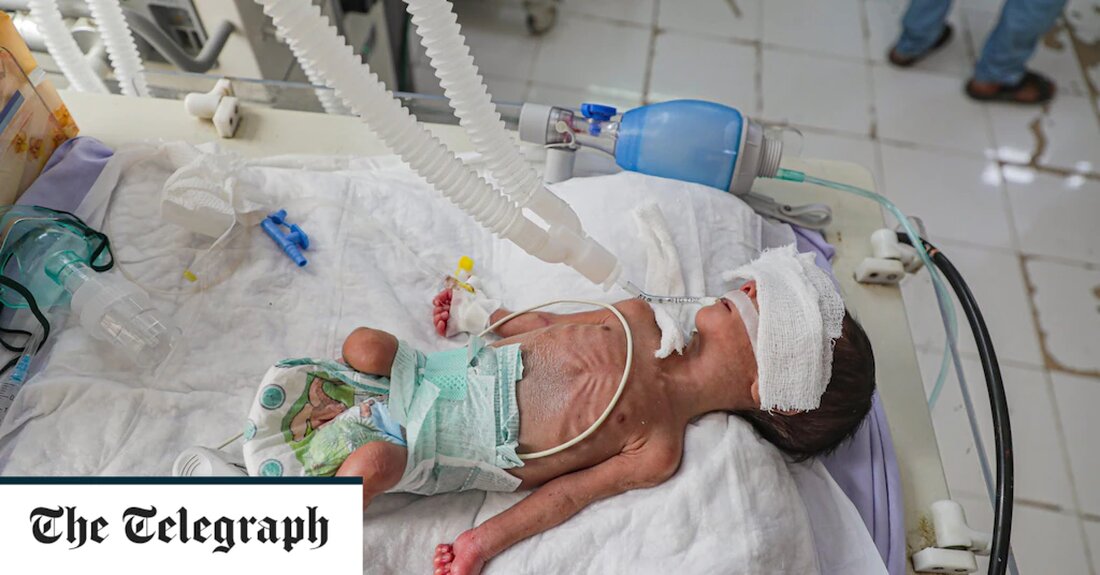 Neun Wochen zu früh geboren und mit einem Gewicht von weniger als drei Pfund liegt Mohammed puppenhaft in einem Krankenhaus-Inkubator, während er um sein Leben kämpft. Die Chancen stehen nicht zu seinen Gunsten. Auf seiner Wochenbett-Intensivstation in Mukalla, einer ehemaligen Al-Qaida-Hochburg im Südjemen, überlebt jedes fünfte Baby nicht. Nach acht Jahren eines brutalen Bürgerkriegs steht das Gesundheitssystem des Landes kurz vor dem Zusammenbruch, da die Wirtschaft des Landes zusammenbricht. „Mütter und Babys sind die größten Opfer dieses Krieges, Kinder [have been] in eine Welt hineingeboren, die für diejenigen, die überleben, hoffnungslos ist“, sagte Dr. Suhair Saeed Omer, ein Spezialist für &hellip;