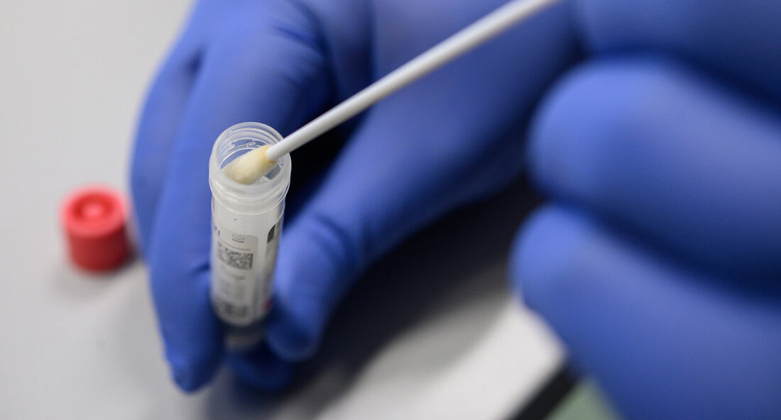 Zukünftig werden die Gesundheitsbehörden nicht mehr routinemäßig Kontakt zu Personen aufnehmen, die positiv auf das Coronavirus getestet wurden. Die behördlich kontrollierte Trennungspflicht gilt jedoch weiterhin. Das bedeutet, dass Ressourcen stärker gebündelt werden, um gefährdete Gruppen zu schützen. das Gesundheitsbehörden In Baden-Württemberg liegt der Fokus künftig noch stärker auf größeren Ausbrüchen und dem Schutz gefährdeter Gruppen, etwa in Alten- und Pflegeheimen. Das bedeutet, dass Personen, die positiv auf das Coronavirus getestet wurden, von nun an nicht mehr routinemäßig von den Gesundheitsbehörden kontaktiert werden. Gleiches gilt aber auch für sie Trennungspflichtdie immer noch von den Behörden kontrolliert wird. Weiterhin Kontrolle durch die …