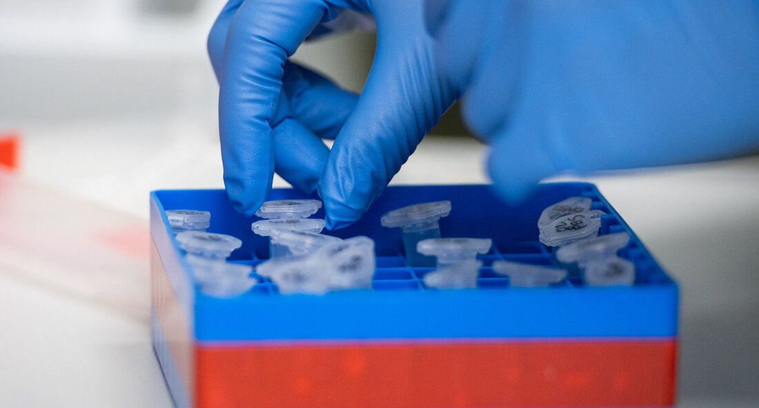 Mit sofortiger Wirkung ist die gezielte Diagnose der Virusmutanten von SARS-CoV-2, die erstmals in Großbritannien und Südafrika auftraten, im State Health Office möglich. Dies ermöglicht eine sehr schnelle Reaktion auf Verdachtsfälle im Land. Die gezielte Diagnose der Virusmutanten von SARS-CoV-2, die erstmals in Großbritannien (B.1.1.7) und Südafrika (B.1.351) auftraten, ist jetzt im State Health Office möglich. Dies ermöglicht eine sehr schnelle Reaktion auf Verdachtsfälle in Baden-Württemberg. Bisher mussten noch Proben von Verdachtsfällen an das Beratungslabor für Coronaviren der Charité Berlin geschickt werden. In den Universitätskliniken sollen zusätzliche Kapazitäten für die sogenannte Sequenzierung geschaffen werden. Diagnostik im Land für gezielte Maßnahmen …