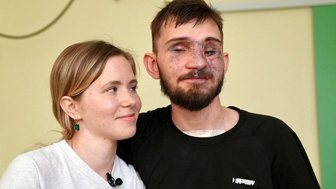 Während die Gegenoffensive der Ukraine weiter voranschreitet – mit begrenzten Erfolgen und keinem entscheidenden Durchbruch – steigt die Zahl der Amputierten im Land sprunghaft an. Nach Angaben des Gesundheitsministeriums in Kiew waren es allein im ersten Halbjahr dieses Jahres 15.000. Wie viele Soldaten es sind, will das Ministerium nicht bekannt geben. Die Behörden überwachen die Zahl der Opfer genau, aber die überwiegende Mehrheit dürfte Militärangehörige sein. Das sind mehr Amputierte in sechs Monaten als im Vereinigten Königreich in den sechs Jahren des Zweiten Weltkriegs, als 12.000 seiner Soldaten Gliedmaßen verloren. Es könnte sein, dass in Europas neuestem Krieg noch viele …