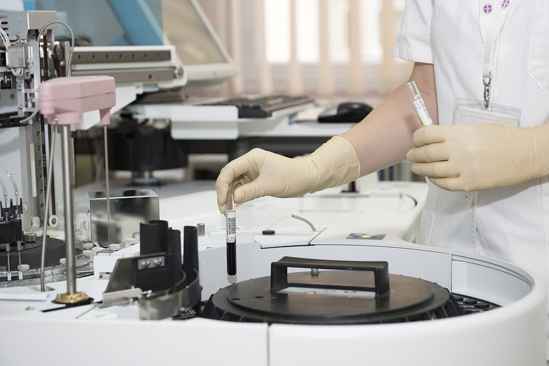 Wie Sie Ihre Gesundheit verbessern können Einführung Eine gute Gesundheit ist von unschätzbarem Wert. Um ein erfülltes und aktives Leben zu führen, sollten wir uns darum bemühen, unsere Gesundheit zu verbessern und zu erhalten. In diesem Artikel werden wir einige bewährte Methoden untersuchen, wie Sie Ihre Gesundheit auf einfache und effektive Weise verbessern können. Regelmäßige körperliche Aktivität Regelmäßige körperliche Aktivität ist einer der wichtigsten Aspekte für die Verbesserung der Gesundheit. Durch Bewegung können wir nicht nur Gewicht verlieren und unsere Figur verbessern, sondern auch das Risiko von Herz-Kreislauf-Erkrankungen, Diabetes und anderen chronischen Krankheiten verringern. Jeder Mensch sollte versuchen, mindestens 30 …